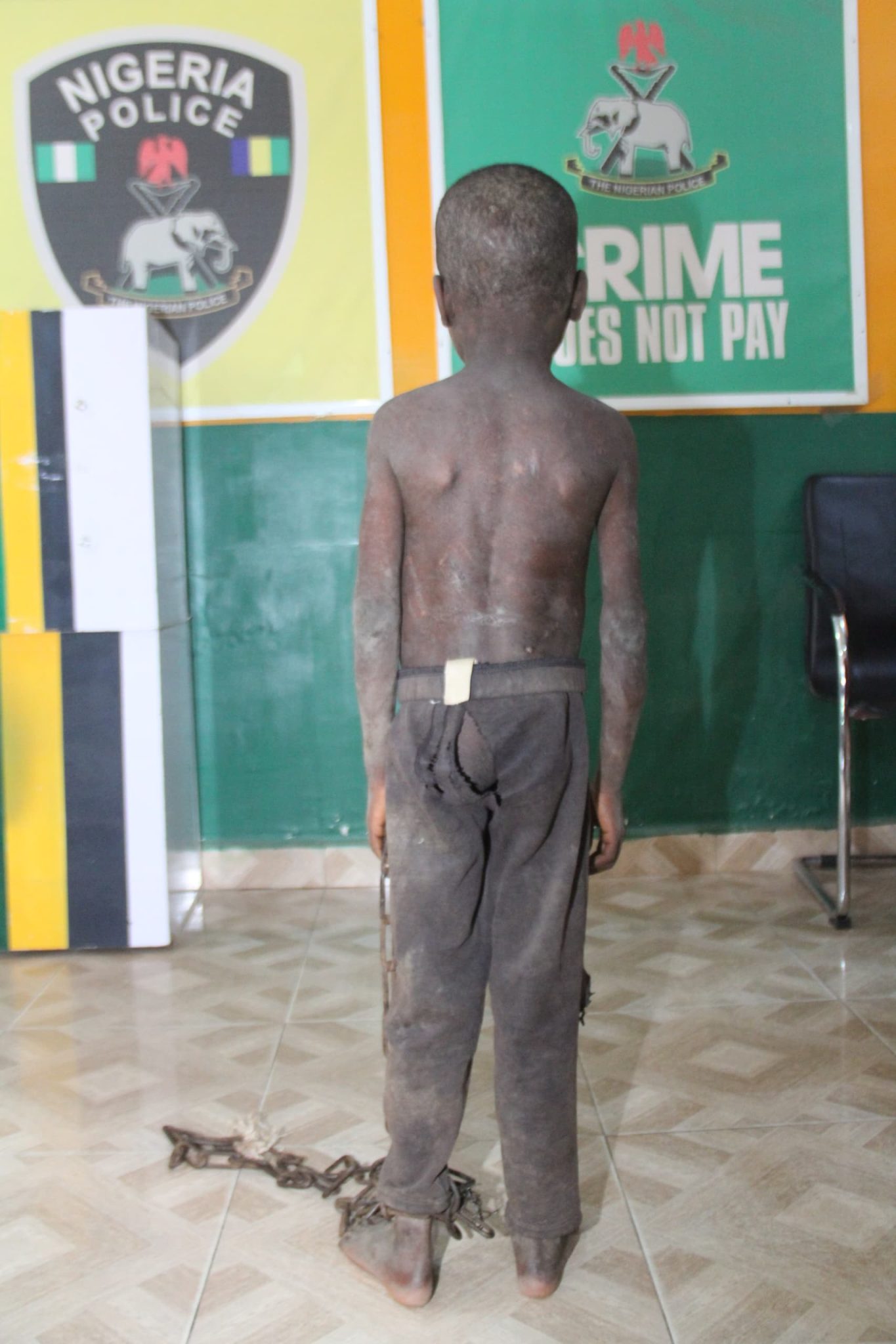 Police Rescue 5-Year-Old Chained, Starved For Three Days By Father (Photo)