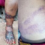 Nursing Mother Disfugured After She Was Allegedly Brutalized By Special Anti Touting Squad In Anambra