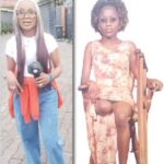 How I Became An Amputee Two Days After My Birthday – Nigerian Businesswoman Tells Her Story