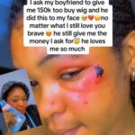 Lady Shares What Boyfriend Did To Her Face After She Requested N150K For Wig (Video)