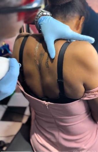 Lady Endures Pain As She Removes Tattoo Of Ex- boyfriend’s Face After Breakup (Video)