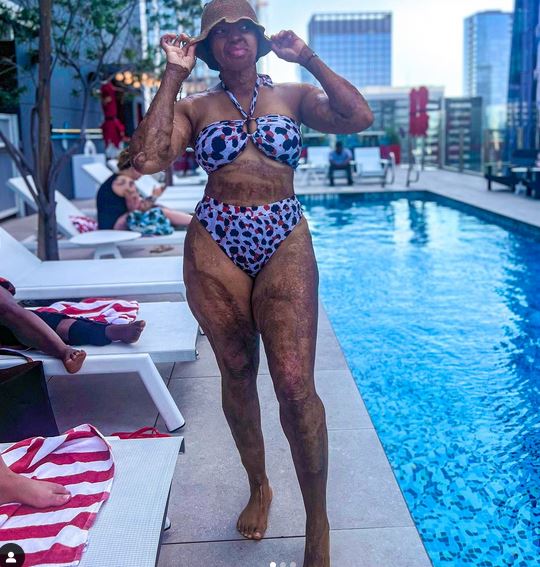 Plane Crash Survivor, Kechi Okwuchi Looks Stunning In A Bikini (Photos)