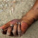 30-Year-Old Man Drowns Inside A Puddle In Kano