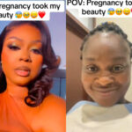 Lady Laments As She Shares Facial Transformation After Getting Pregnant