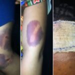 Nigerian Lawyer Rescues 23-year-old Woman Allegedly Brutalized By Her Boyfriend