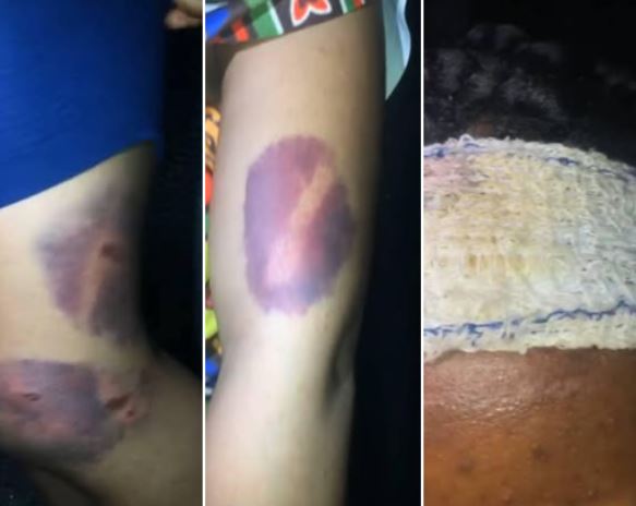 Nigerian Lawyer Rescues 23-year-old Woman Allegedly Brutalized By Her Boyfriend